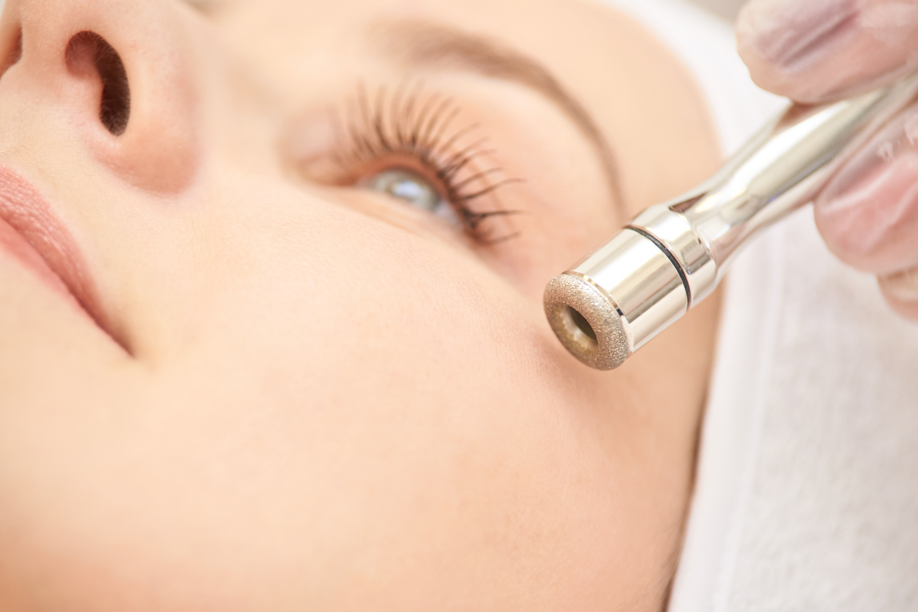 DIAMANT DERMABRASION